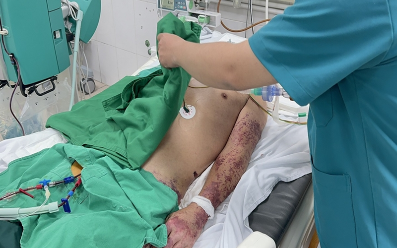6 khuyến cáo của Bộ Y tế về phòng, chống bệnh liên cầu lợn ở người