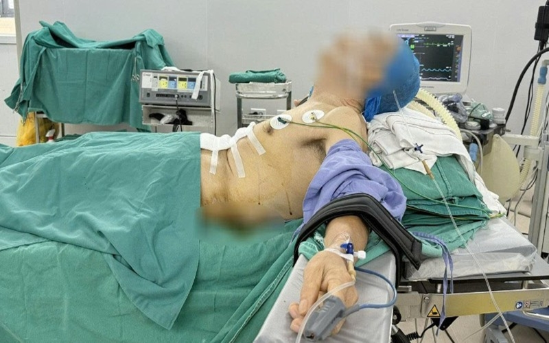 Phẫu thuật thành công cho bệnh nhân ung thư dạ dày bị gù vẹo cột sống nặng