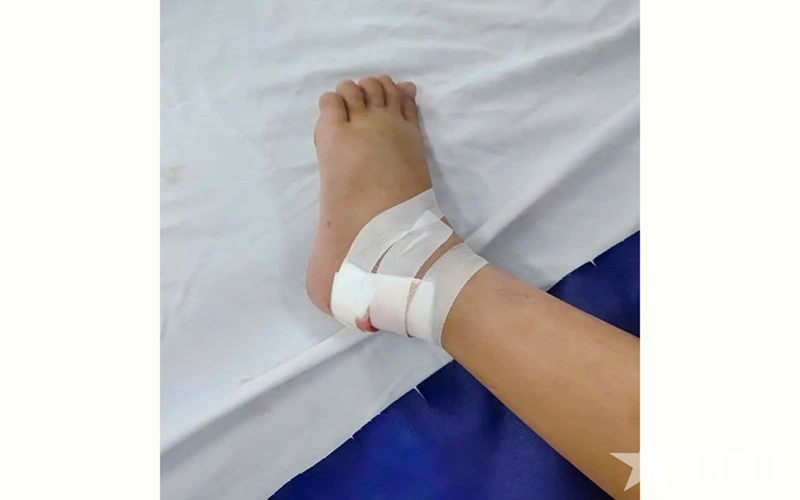 Cần Thơ: Cảnh báo nguy cơ rắn cắn trẻ nhỏ trong mùa nước nổi